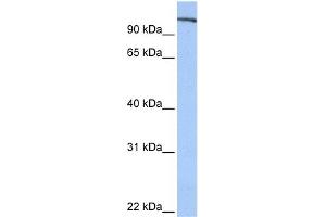 WB Suggested Anti-FES Antibody Titration: 0. (FES Antikörper  (N-Term))