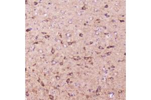 Immunohistochemistry (IHC) image for anti-Insulin-Like Growth Factor Binding Protein 2, 36kDa (IGFBP2) (AA 35-304) antibody (ABIN6654166)