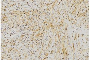 ABIN6272968 at 1/100 staining Mouse muscle tissue by IHC-P.
