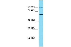Host: Rabbit Target Name: R3HCC1L Sample Type: HepG2 Whole Cell lysates Antibody Dilution: 1. (GIDRP88 Antikörper  (C-Term))