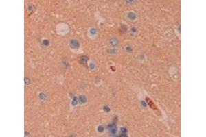 IHC-P analysis of Human Tissue, with DAB staining. (Peroxiredoxin 4 Antikörper  (AA 6-249))