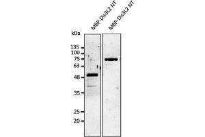 Western Blotting (WB) image for anti-DIS3-Like Exonuclease 2 (DIS3L2) (N-Term) antibody (ABIN7272981) (DIS3L2 Antikörper  (N-Term))