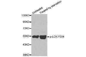 Western blot analysis of extracts from JK cells, using phospho-LCK-Y394 polyclonal antibody (ABIN2987539). (LCK Antikörper  (pTyr394))