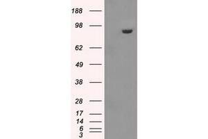 Image no. 1 for anti-Glucan (1,4-alpha-), Branching Enzyme 1 (GBE1) antibody (ABIN1498396) (GBE1 Antikörper)