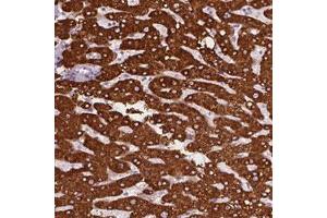 Immunohistochemical staining (Formalin-fixed paraffin-embedded sections) of human liver with CES1 polyclonal antibody  shows strong cytoplasmic positivity in hepatocytes. (CES1 Antikörper)