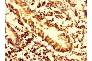Immunohistochemistry of paraffin-embedded human appendix tissue using ABIN7155576 at dilution of 1:100