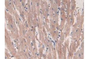 IHC-P analysis of Rat Heart Tissue, with DAB staining. (CS Antikörper  (AA 56-312))