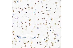 Immunohistochemistry (IHC) image for anti-SET Nuclear Oncogene (SET) (AA 1-277) antibody (ABIN6147631)