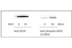 EGFR ELISA Kit