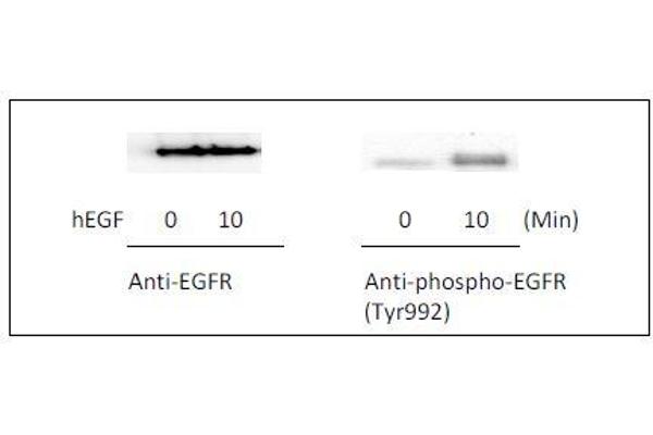 EGFR ELISA Kit