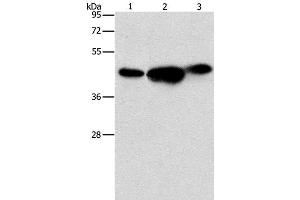 Western Blot analysis of 293T, PC3 and NIH/3T3 cell using ARFGAP1 Polyclonal Antibody at dilution of 1:850 (ARFGAP1 Antikörper)
