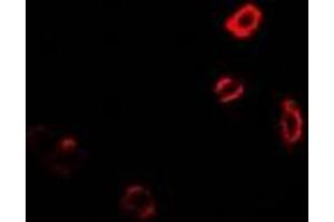 Immunofluorescent analysis of GNT1 staining in MCF7 cells. (Ugt1 Antikörper)