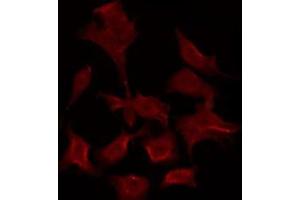 ABIN6275914 staining HepG2 by IF/ICC.