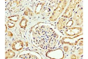 IHC image of ABIN7146841 diluted at 1:200 and staining in paraffin-embedded human kidney tissue performed on a Leica BondTM system. (CPT2 Antikörper  (AA 388-551))