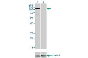 Western blot analysis of EPHA3 over-expressed 293 cell line, cotransfected with EPHA3 Validated Chimera RNAi (Lane 2) or non-transfected control (Lane 1). (EPH Receptor A3 Antikörper  (AA 202-326))