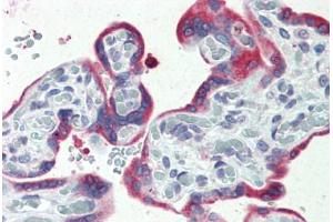 Human, Placenta: Formalin-Fixed Paraffin-Embedded (FFPE) (ERP44 Antikörper  (C-Term))