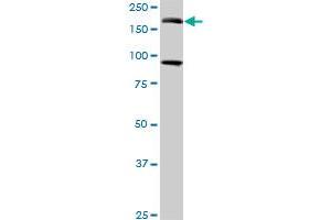 Western Blotting (WB) image for anti-Eukaryotic Translation Initiation Factor 4 gamma 3 (EIF4G3) (AA 1-516) antibody (ABIN599055) (EIF4G3 Antikörper  (AA 1-516))