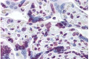 Human Placenta: Formalin-Fixed, Paraffin-Embedded (FFPE) (RBM5 Antikörper  (AA 75-184))