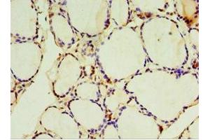 Immunohistochemistry of paraffin-embedded human thyroid tissue using ABIN7170959 at dilution of 1:100 (SULT1C2 Antikörper  (AA 1-120))