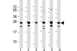Western blot testing of human 1) HeLa, 2) HepG2, 3) Jurkat, 4) Raji, 5) 293 and 6) 293T/17 cell lysate with PCMT1 antibody at 1:2000. (PCMT1 Antikörper  (AA 93-126))