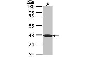 WB Image Sample (30 ug of whole cell lysate) A: Molt-4 , 10 % SDS PAGE antibody diluted at 1:1000 (BEND5 Antikörper)