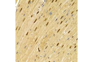 Immunohistochemistry of paraffin-embedded rat heart using CDC25A antibody (ABIN5970519) at dilution of 1/100 (40x lens). (CDC25A Antikörper)
