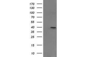Image no. 1 for anti-PIH1 Domain Containing 2 (PIH1D2) antibody (ABIN1500197) (PIH1D2 Antikörper)