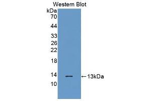 Western blot analysis of the recombinant protein. (Melatonin Receptor 1A Antikörper  (AA 296-350))