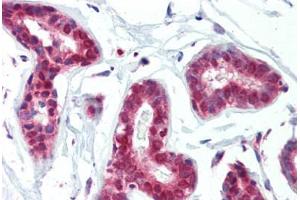 Human Breast (formalin-fixed, paraffin-embedded) stained with PRMT1 antibody ABIN462306 followed by biotinylated goat anti-rabbit IgG secondary antibody ABIN481713, alkaline phosphatase-streptavidin and chromogen. (PRMT1 Antikörper  (AA 317-346))
