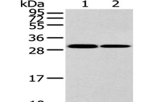 Western Blot analysis of K562 and 293T cell using HNRNPC Polyclonal Antibody at dilution of 1/200 (HNRNPC Antikörper)