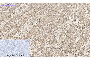 Immunohistochemical analysis of paraffin-embedded human uterus tissue. (BMP2 Antikörper  (C-Term))