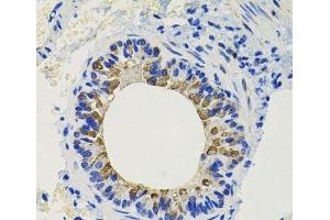Immunohistochemistry of paraffin-embedded Mouse lung using CALB2 Polyclonal Antibody at dilution of 1:100 (40x lens). (Calretinin Antikörper)