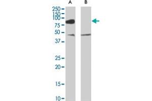 ZDHHC8 polyclonal antibody  (0.