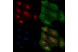 ABIN6257837 and ABIN6275222 staining  cells by IF/ICC. (MED8 Antikörper  (C-Term))