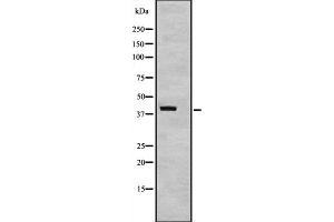 Western blot analysis of TAF7 expression in TAF7 transfected 293T cell lysate,The lane on the left is treated with the antigen-specific peptide. (TAF7 Antikörper  (Internal Region))
