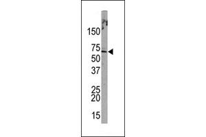 Western blot analysis of anti-L Sumoylation Site Antibody (Cat. (PML Antikörper  (Sumoylation Site))