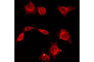 ABIN6268695 staining HepG2 by IF/ICC. (CD34 Antikörper  (Internal Region))