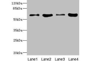 Western blot All lanes: PIP5K1A antibody at 4.