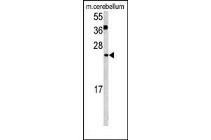 Figure 1. (Glutaredoxin 2 Antikörper  (C-Term))