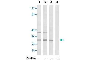Western blot analysis of extracts from COLO cells (Lane 1), HeLa cells (Lane 2) and HUVEC cells (Lane 3 and lane 4), using RPS4Y1 polyclonal antibody . (RPS4Y1 Antikörper  (C-Term))