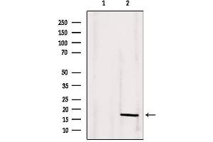 Western blot analysis of extracts from 293, using ANG Antibody.