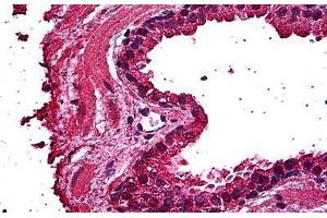 Human Prostate, Epithelium: Formalin-Fixed, Paraffin-Embedded (FFPE) (ERN1 Antikörper  (AA 401-500))