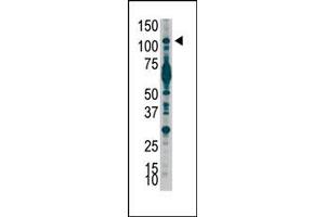 Image no. 1 for anti-Phosphoinositide-3-Kinase, Catalytic, beta Polypeptide (PIK3CB) (C-Term) antibody (ABIN360447) (PIK3CB Antikörper  (C-Term))