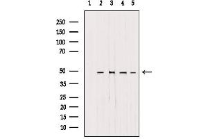 Western blot analysis of extracts from various samples, using AP1M1 antibody. (AP1M1 Antikörper  (Internal Region))