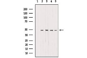 AP1M1 Antikörper  (Internal Region)