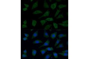 Immunofluorescence (IF) image for anti-FYVE, RhoGEF and PH Domain Containing 1 (FGD1) (AA 700-800) antibody (ABIN7267284)