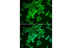 Immunofluorescence analysis of A549 cells using KEAP1 antibody. (KEAP1 Antikörper)