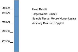 Host: Rabbit Target Name: SMAD6 Sample Tissue: Mouse Kidney Antibody Dilution: 1ug/ml
