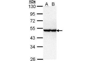 WB Image Sample (30 ug of whole cell lysate) A: Hela B: Hep G2 , 10% SDS PAGE antibody diluted at 1:1000 (STK40 Antikörper)