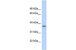 WB Suggested Anti-GAPDH Antibody Titration: 0. (GAPDH Antikörper  (Middle Region))